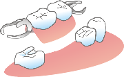 義歯.png