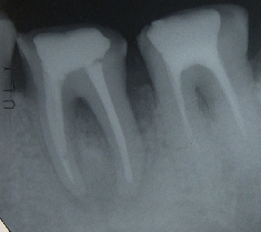 骨再生04_01.jpg