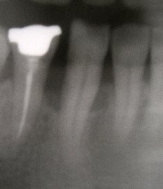 骨再生05_01.jpg