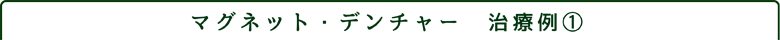 マグネット・デンチャー01.jpg