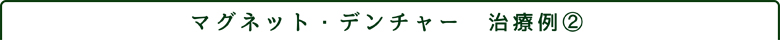 マグネット・デンチャー02.jpg