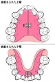 床矯正02.jpg