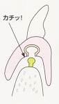 miniimplant02.jpg