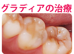 グラディア文字入り.png